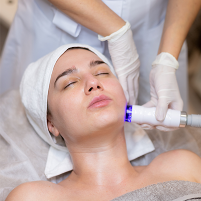 Photo Facial